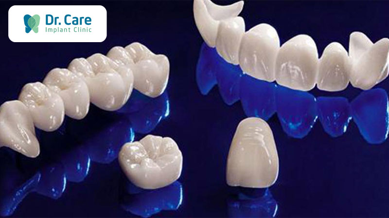 Bọc răng sứ là gì? 4 loại răng sứ phổ biến hiện nay