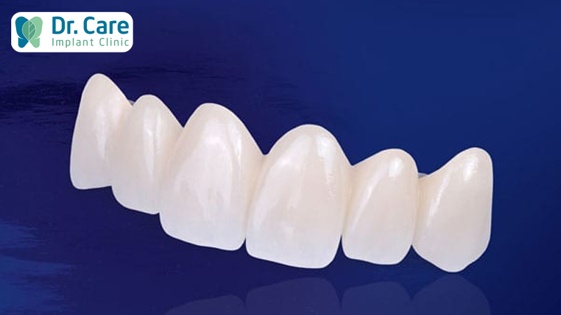 Top 5 dòng răng toàn sứ chất lượng tốt nhất