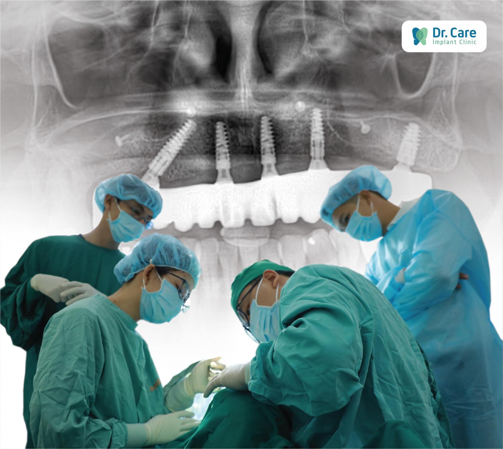 Kỹ thuật Socket Shield đòi hỏi bác sĩ thực hiện phải có chuyên môn cao, giàu kinh nghiệm, và đôi tay khéo léo để chẩn đoán chính xác tình trạng răng miệng của cô chú/anh chị và xác định chính xác tuyệt đối vị trí đặt Implant. 
