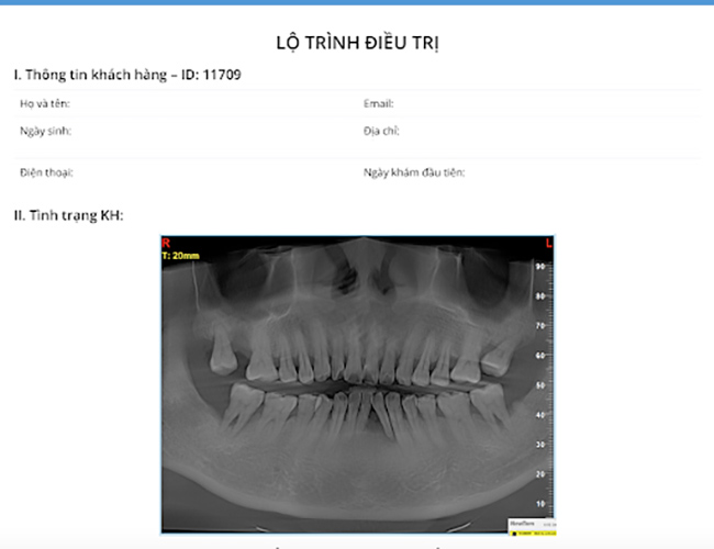 Trồng răng implant tại Dr. Care với liệu trình điều trị rõ ràng, minh bạch