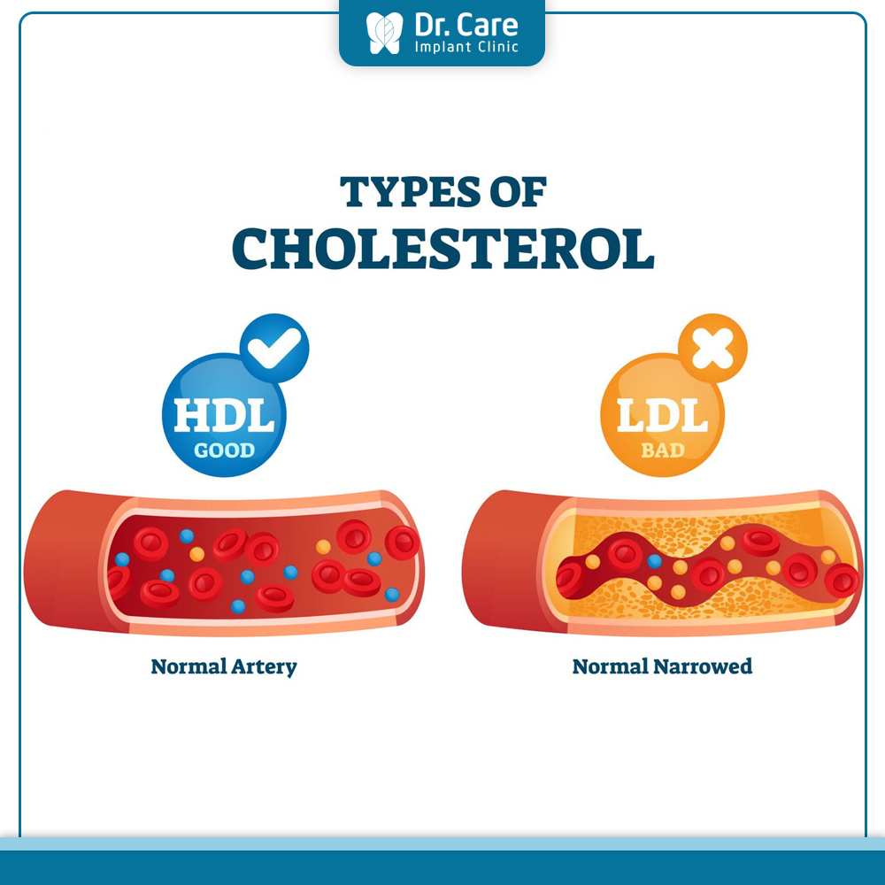 HDL-Cholesterol nghĩa là gì?