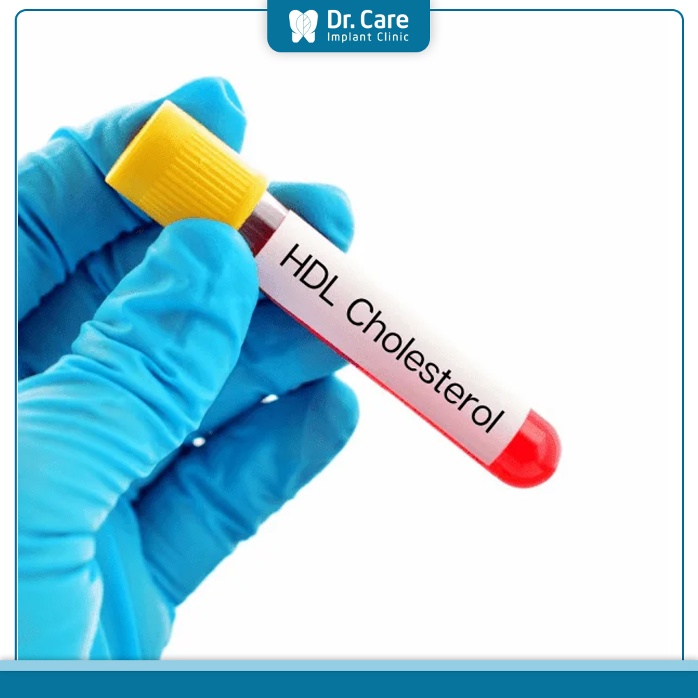 Xét nghiệm HDL-Cholesterol