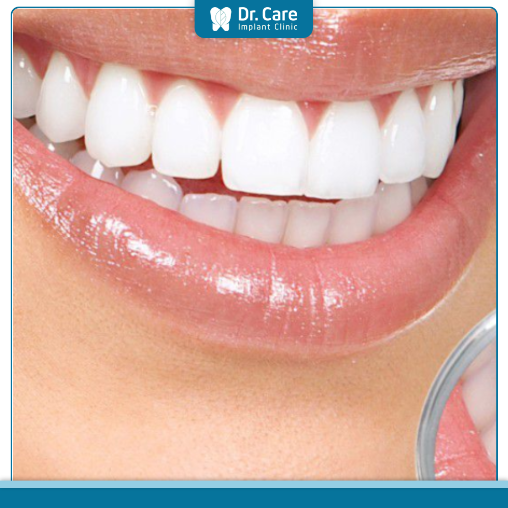 Sự khác nhau giữa bọc răng sứ bảo tồn và bọc răng sứ thẩm mỹ