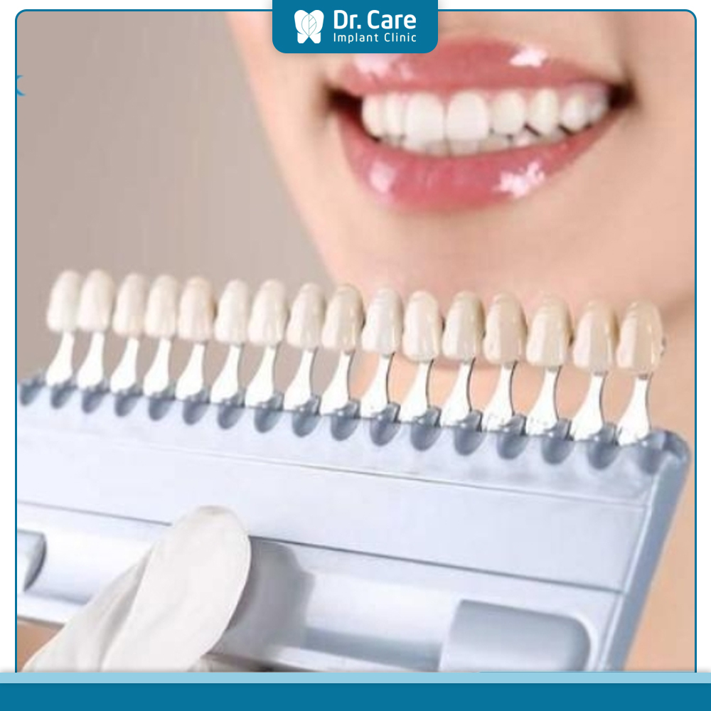 Răng sứ HT Smile có bảng màu đa dạng với 16 tông giúp Cô Chú, Anh Chị dễ dàng lựa chọn màu sắc phù hợp