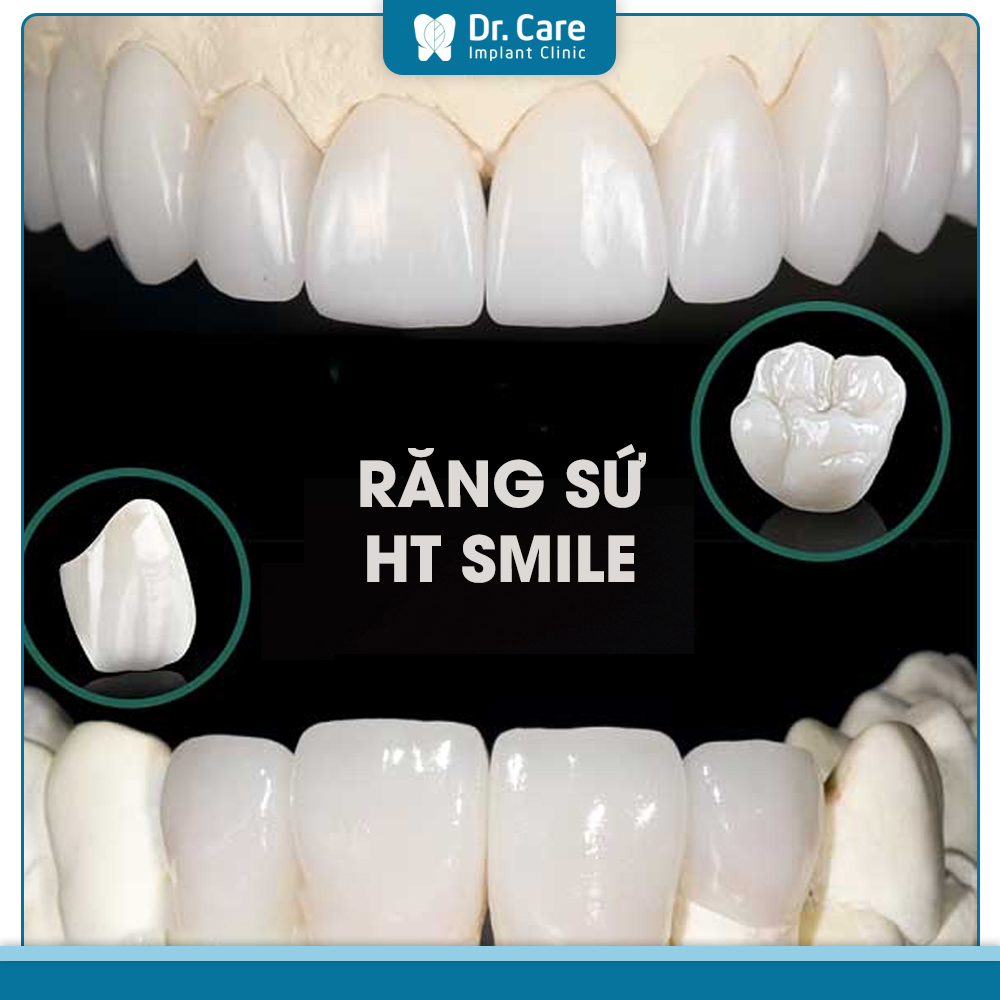 Răng sứ HT Smile có giá dao động khoảng 6.000.000 – 8.000.000 đồng/răng