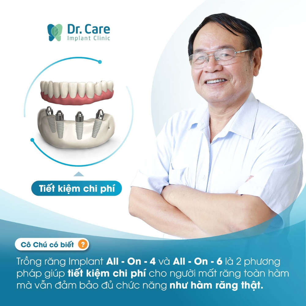 Chi phí hợp lý trồng răng Implant tại Dr. Care