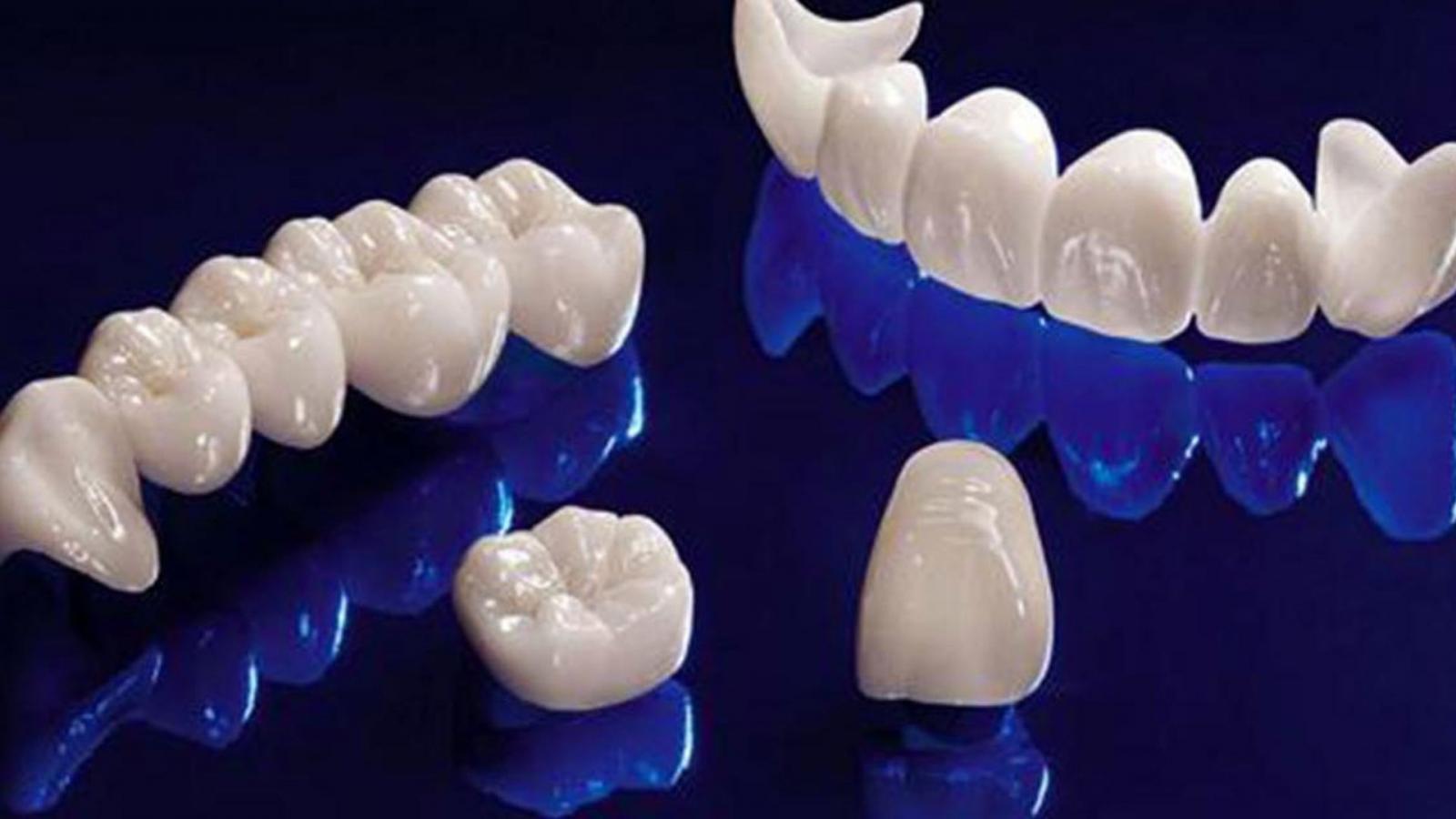 Các loại răng sứ thường được sử dụng 