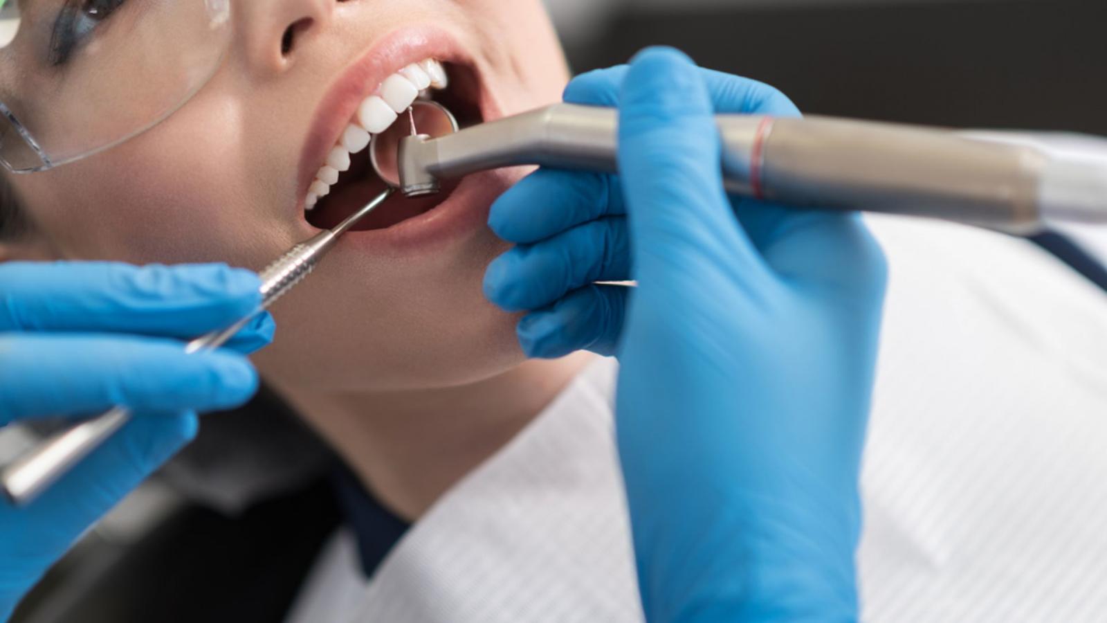 Lưu ý khi bọc răng sứ để hạn chế biến chứng xảy ra