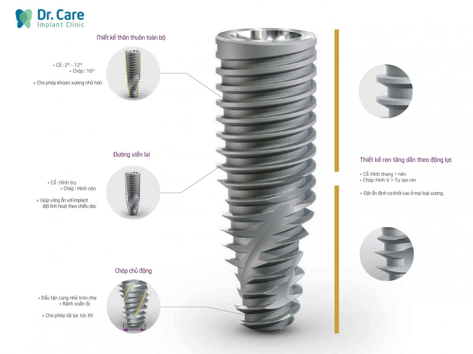 Lợi ích Implant Neodent mang lại cho người dùng