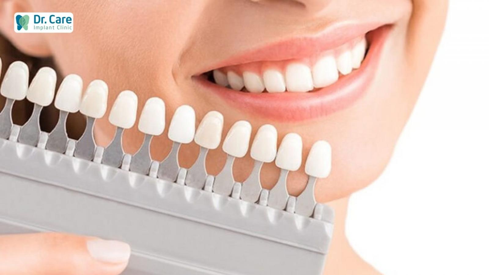 3 lợi ích tuyệt vời của bọc răng sứ