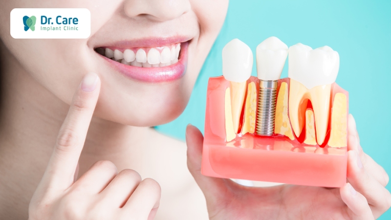 Hiệu quả của việc trồng răng hàm số 6 bằng cấy ghép Implant (trồng răng Implant)