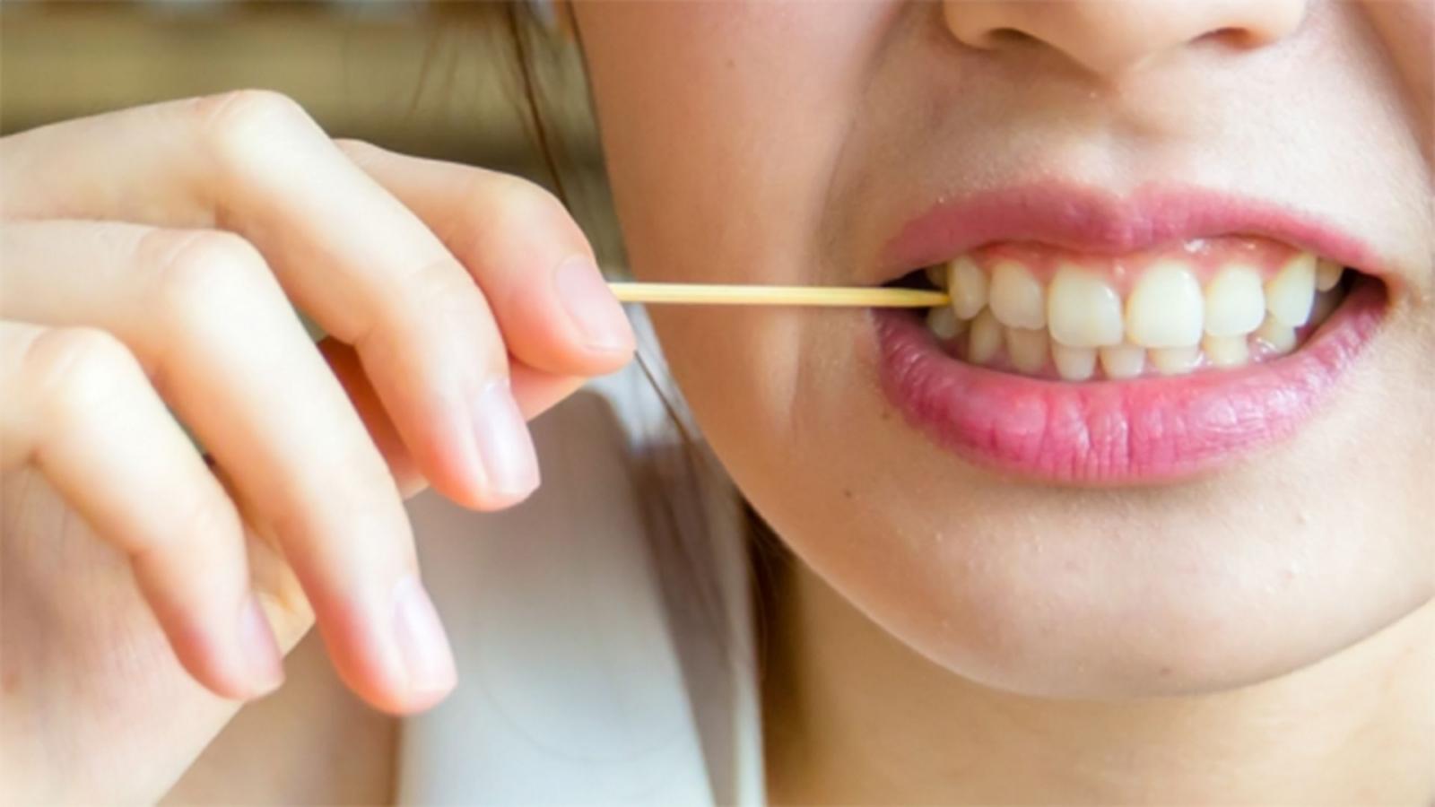 Sau khi mài răng bọc sứ nên kiêng gì?