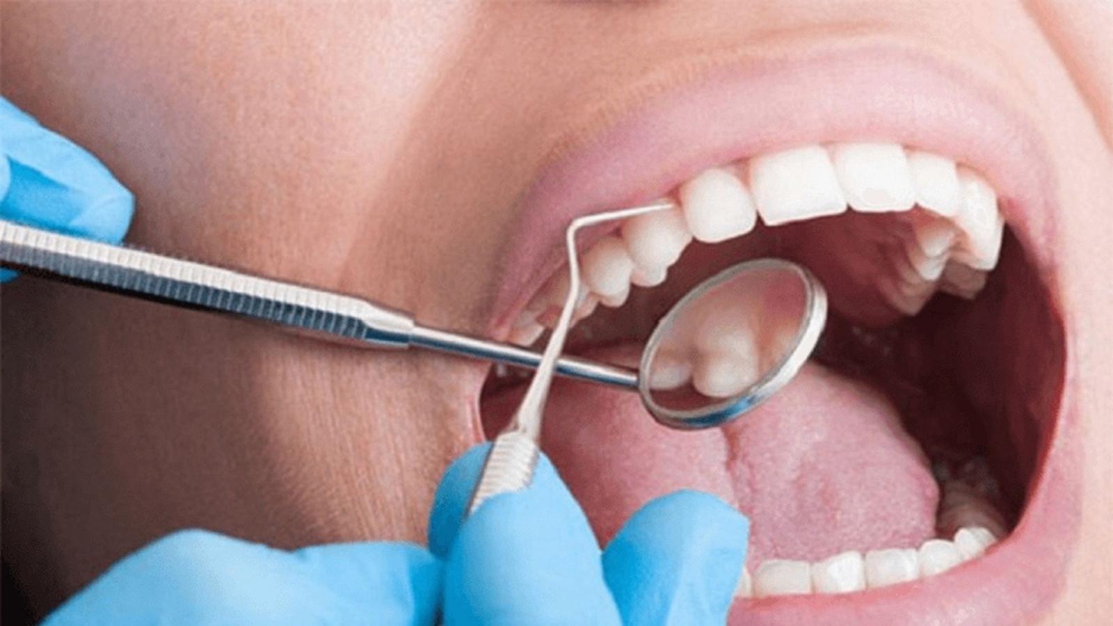 Cách khắc phục sưng nướu răng sau khi bọc răng sứ