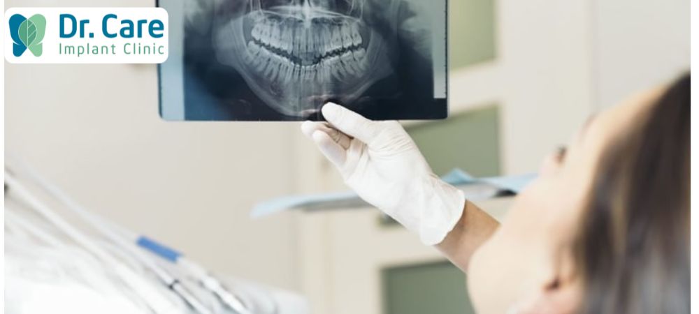 Chẩn đoán bệnh viêm nướu răng tại Nha khoa bằng dụng cụ chuyên biệt, chụp X-quang 
