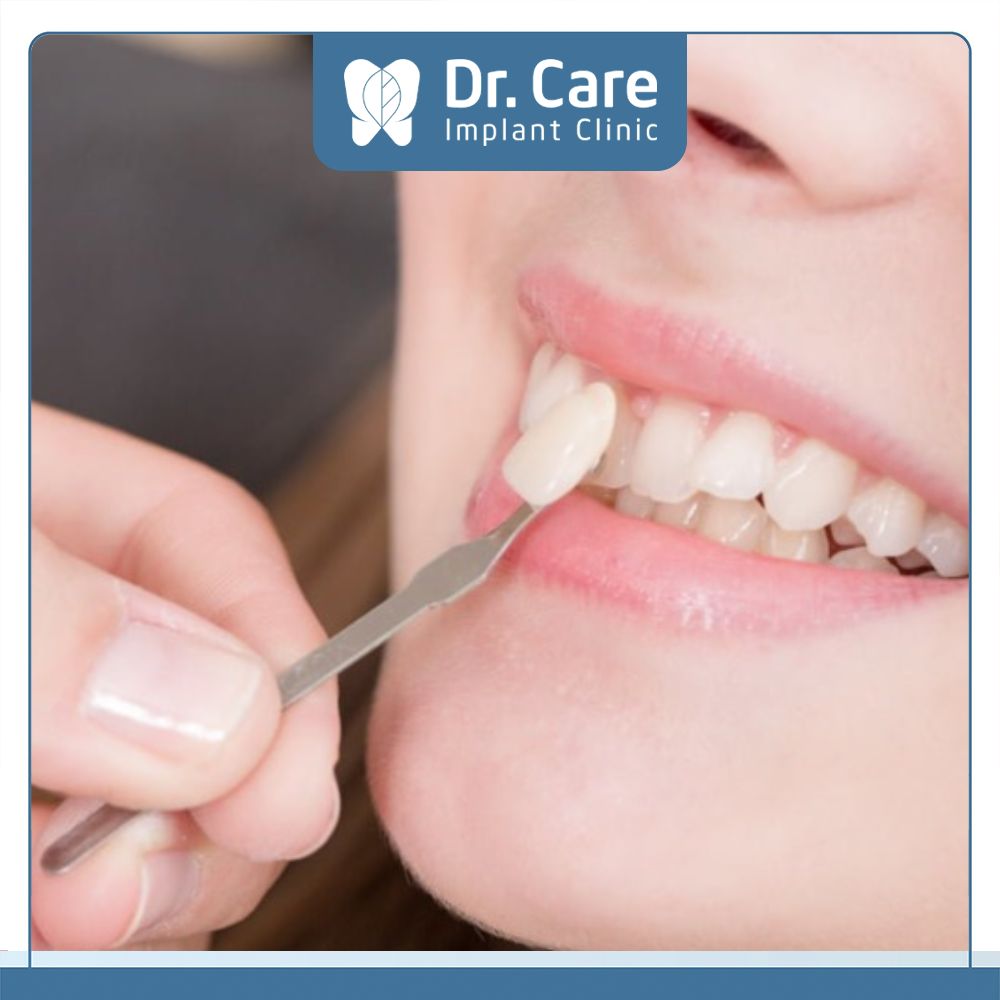 Trám răng Composite đem lại kết quả điều trị tối ưu, nhất là ở tính thẩm mỹ cao vì có màu sắc gần giống răng thật
