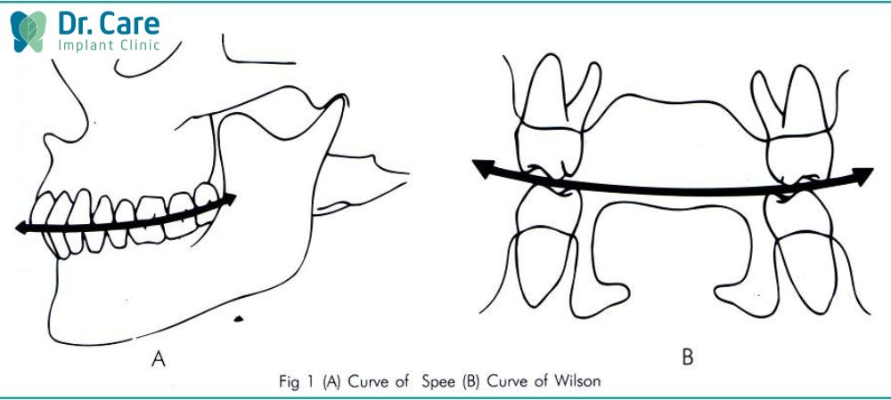 Đường cong Spee là đường cong phẳng đảm bảo cho sự ổn định của khớp cắn, cong lõm nhẹ lên trên