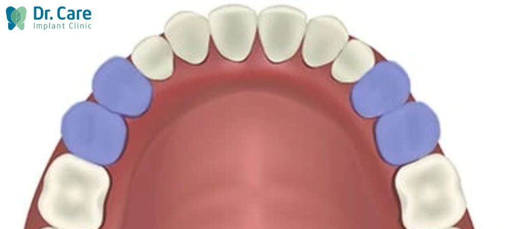 Nhóm răng cối nhỏ là răng kế cận răng nanh tính vào phía trong. Đối với các răng cối nhỏ, theo cách đọc vị trí trên cung răng thì chúng thường có số thứ tự 4, 5