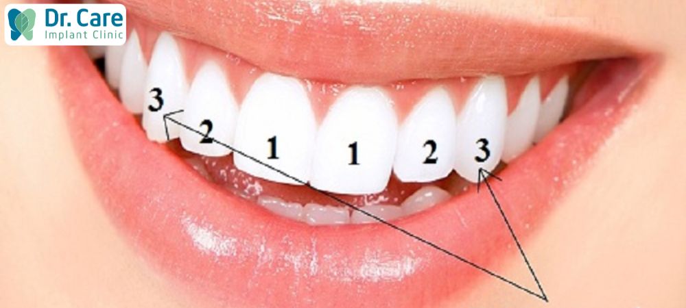 Nhóm răng trước gồm 12 răng được đánh số từ 1 đến 3 đối với cả hàm trên và hàm dưới
