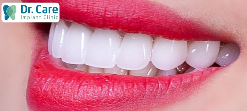Đối với màu răng sứ Lava trắng trong thì sẽ phù hợp với làm da trắng, tăng thẩm mỹ cao