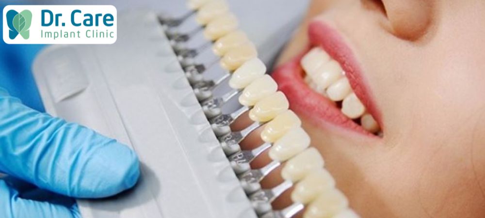 Màu răng sứ giống tương đương với răng thật để tạo sự hài hòa, tự nhiên nhất
