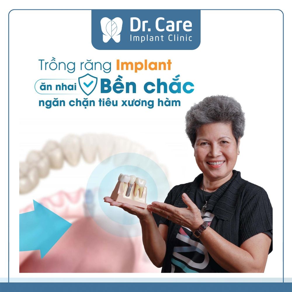 Dr. Care cung cấp các dịch vụ trồng răng Implant hiện đại và phù hợp với từng tình trạng mất răng riêng biệt