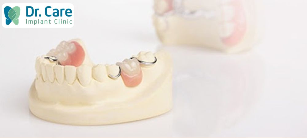 Giá răng giả tháo lắp sẽ khoảng từ 800.000đ – 1.000.000đ/răng trở lên