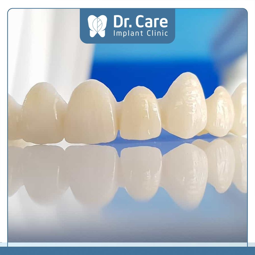 Răng sứ IPS Emax Ceram được cấu tạo từ sứ thủy tinh fluorapatite và được phủ thêm lớp zirconia dioxide