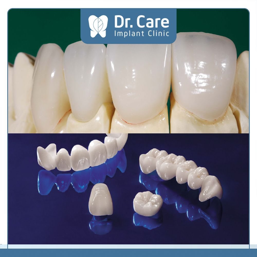 Cả hai dòng răng sứ Emax và Zirconia đều được đánh giá cao trong lĩnh vực nha khoa nhưng chúng có những điểm khác biệt đáng kể