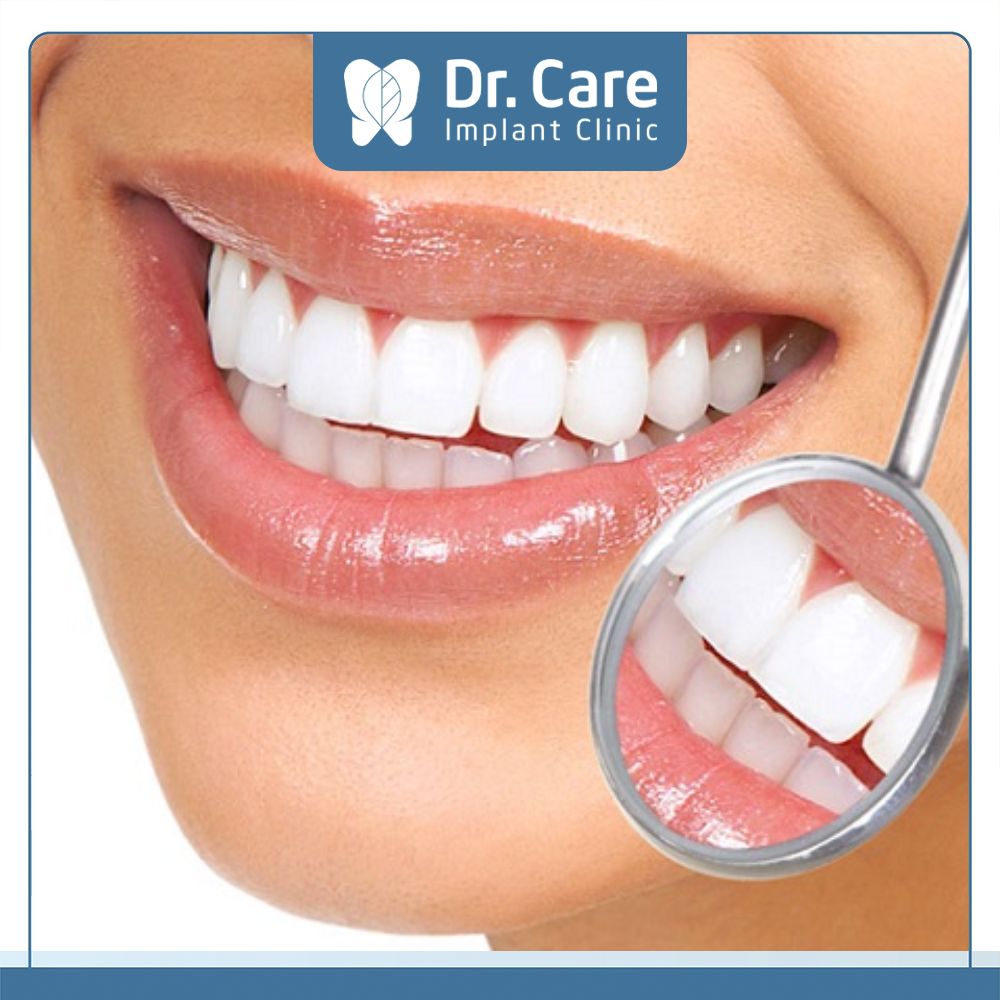 Răng sứ HT Smile có màu sắc trắng tự nhiên như răng thật, làm tăng tính thẩm mỹ