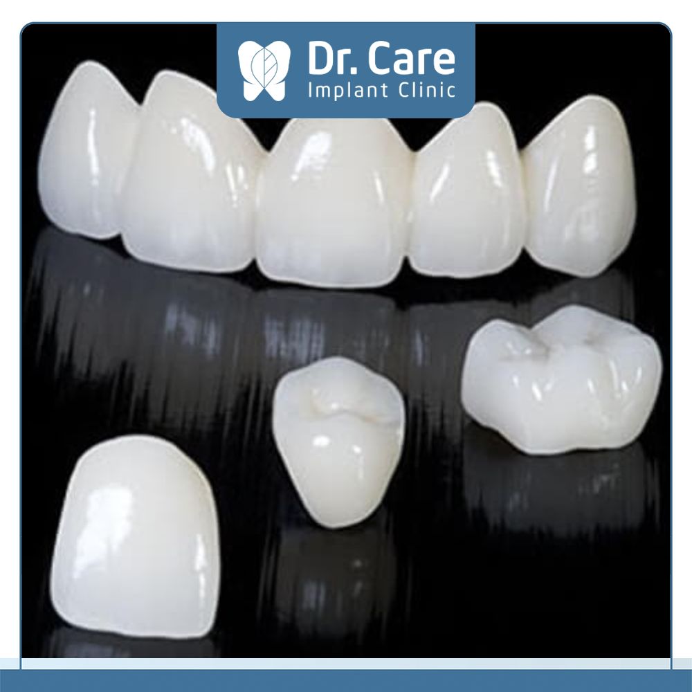 Răng sứ toàn sứ thì theo thời gian sử dụng độ trắng bóng vẫn giữ tốt như lúc ban đầu, tuổi thọ của răng toàn sứ trung bình từ 15 – 20 năm