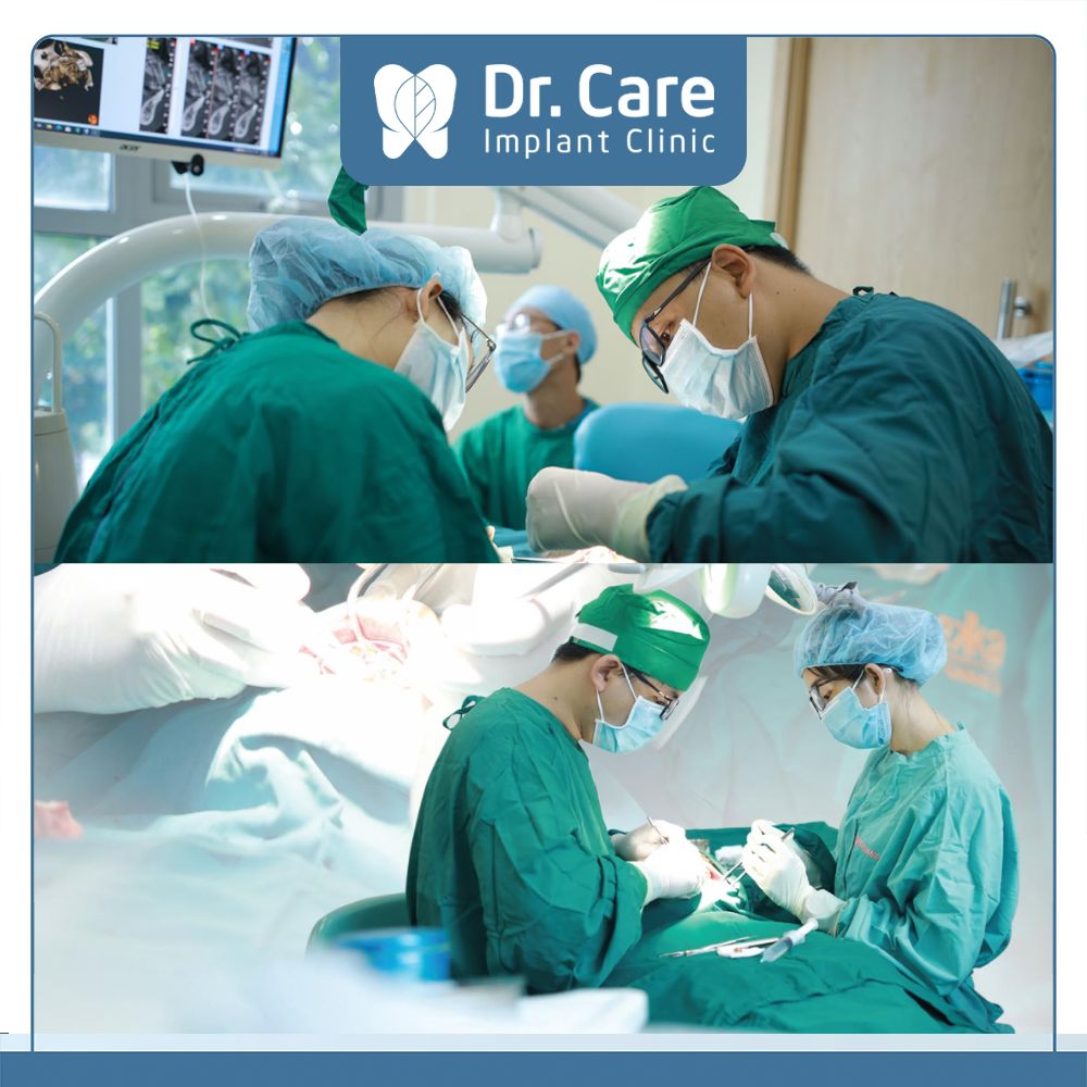 Trồng răng Implant hạn chế sưng đau, an toàn, hiệu quả tại Dr. Care