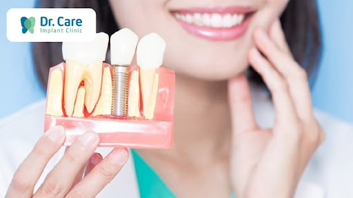 Phục hồi răng bị mất do viêm nướu không điều trị kịp thời 