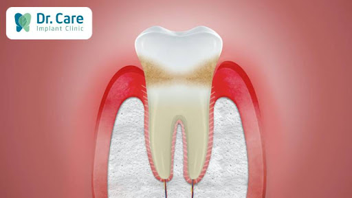 Nướu răng là gì? Cách nhận biết nướu răng khỏe mạnh
