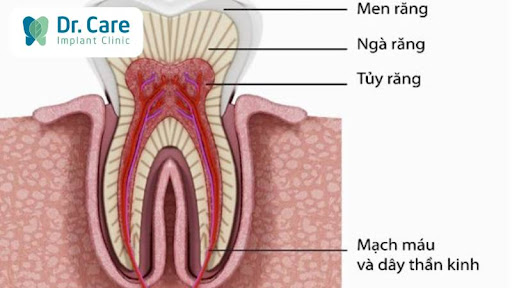Viêm tủy răng số 8 là gì?