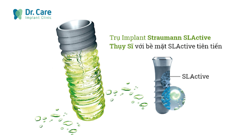 Trụ Implant Straumann (Thụy Sĩ) dòng trụ cao cấp trồng Implant toàn hàm