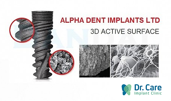 Implant Alphadent - trụ răng đầu tiên trên thế giới có công nghệ xử lý bề mặt đặc biệt 3D Active