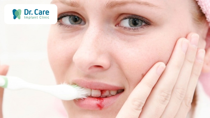 Vệ sinh răng miệng sai cách sau khi làm cầu răng sứ