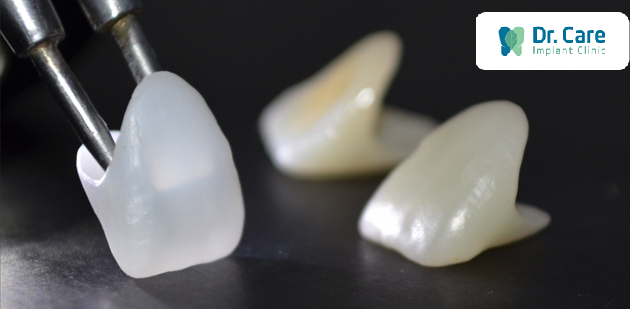 2 Nhược điểm phổ biến của răng sứ Cercon