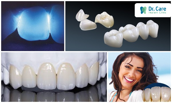 4 Ưu điểm nổi bật của răng sứ Cercon
