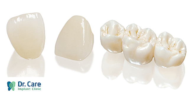 3 loại răng lõi sứ Titan phổ biến