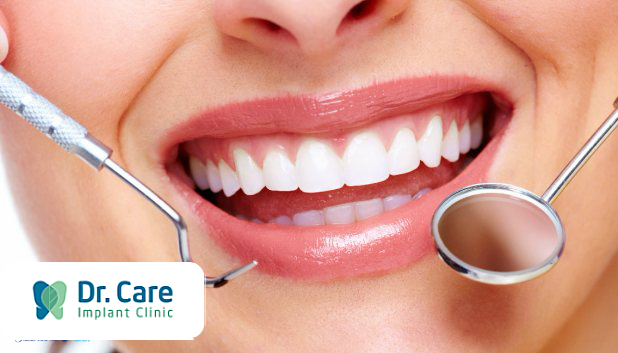 6 ưu điểm nổi bật của trụ Implant Yes Biotech