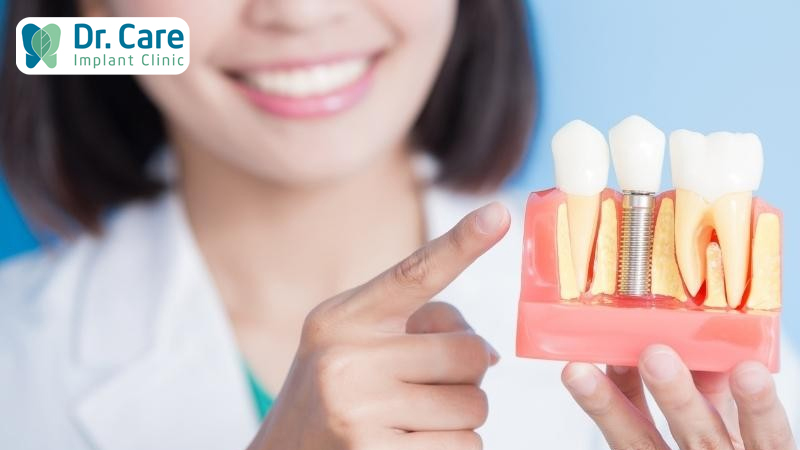 Hướng dẫn chăm sóc răng miệng sau khi trồng răng Implant