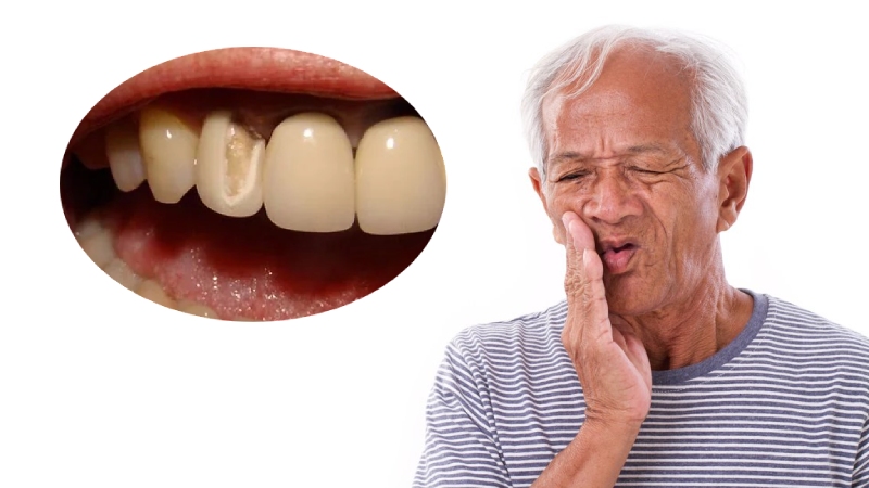 Răng sứ nứt, vỡ sau thời gian ngắn sử dụng