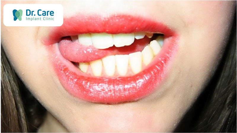 Tình trạng răng cắn lưỡi là gì?