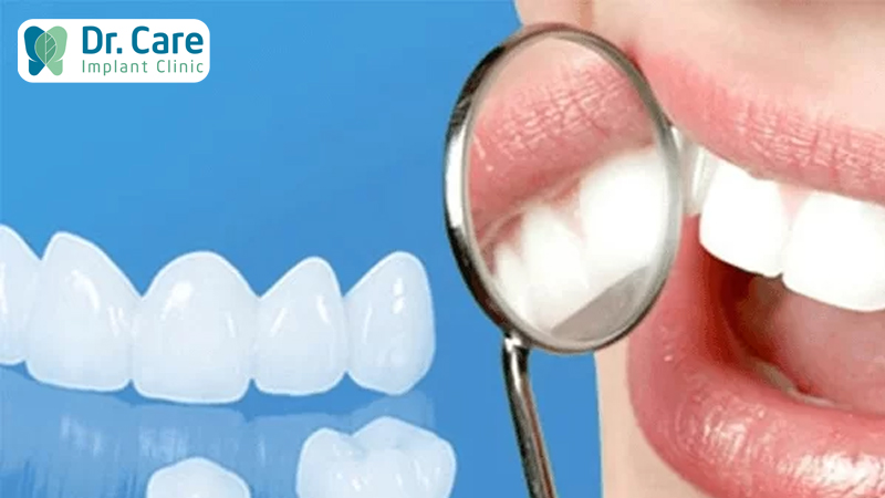 Bọc răng sứ Zirconia có tốt không?