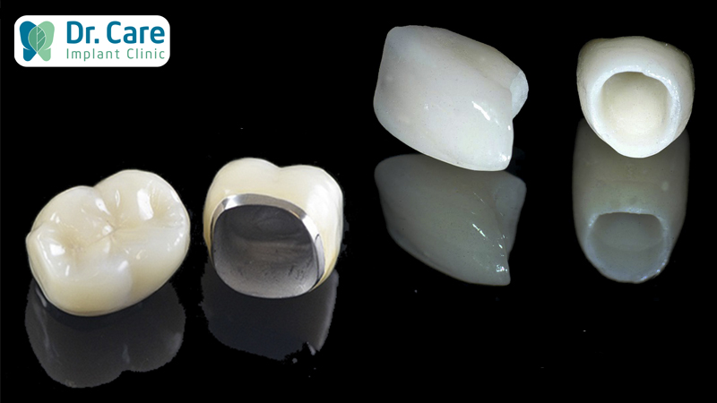 Răng sứ Zirconia và răng sứ Titan khác nhau như thế nào?