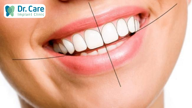 Hàm răng đẹp có đường cung răng cân đối với khuôn mặt