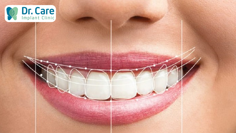 Hàm răng chuẩn giúp nụ cười thêm nổi bật