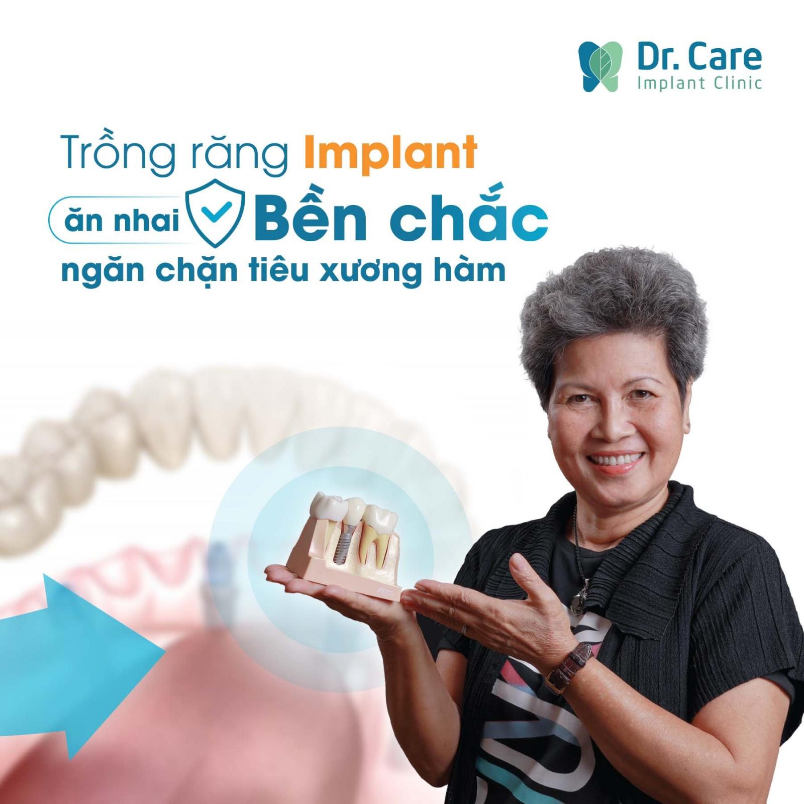 Trồng răng giả bao lâu thì có thể ăn uống như thường?