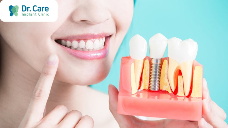 Độ tuổi trồng răng Implant thích hợp nhất